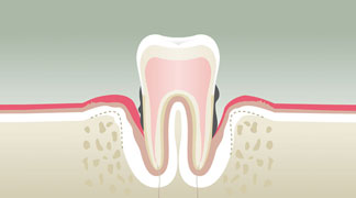 Parodontologie & Hygiène Libourne